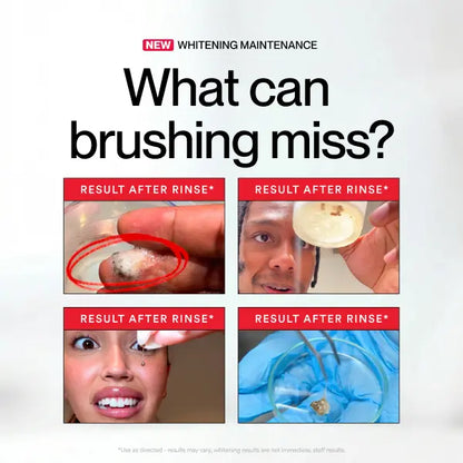 Whitening Mouthwash - Stain-Removing Rinse For A Brighter Smile