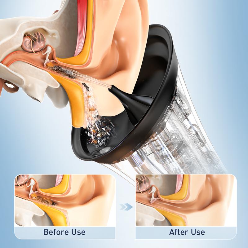 Electric Ear Cleaner - Controlled Water Irrigation For Easy At-Home Ear Care