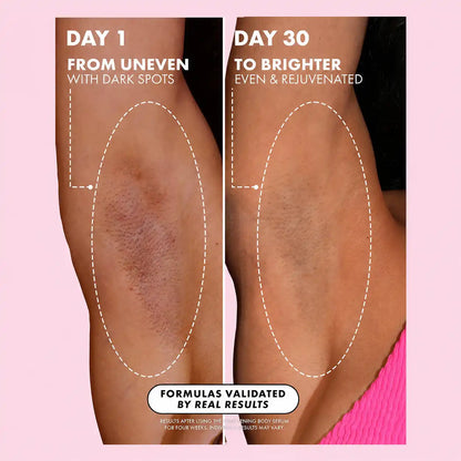 Brightening Body Serum - Vitamin C + Tranexamic Acid For Even-Looking, Radiant Skin