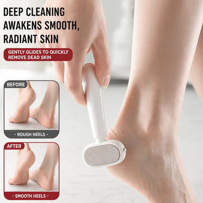 Foot Callus Remover - Dual-Sided Stainless Steel Filing For Smooth Soft Heels