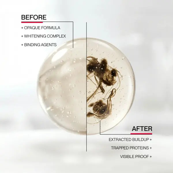 Whitening Mouthwash - Stain-Removing Rinse For A Brighter Smile