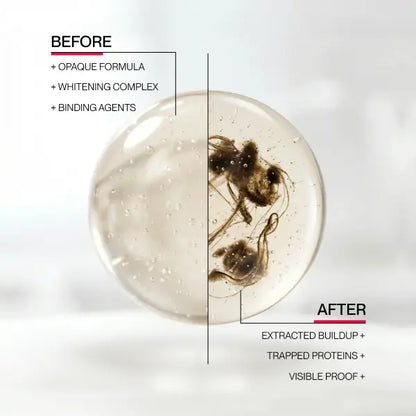 Whitening Mouthwash - Stain-Removing Rinse For A Brighter Smile
