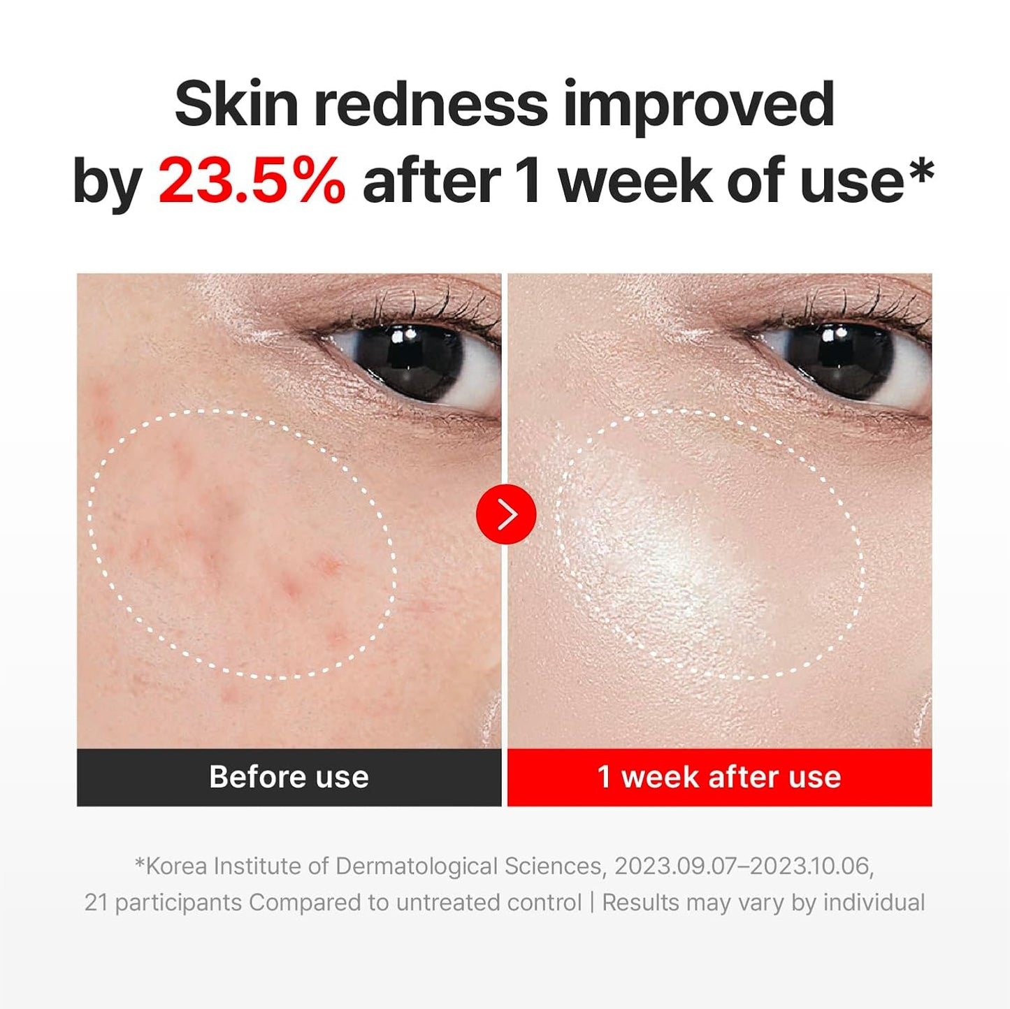 TECA-Infused Time Reverse Recovery Face Cream
