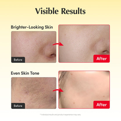 Vitamin Brightening Duo - Acerola + Niacinamide For A More Radiant, Even-Looking Glow