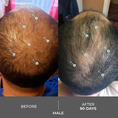Hair Density Shampoo - Advanced Formula For Fuller, Thicker-Looking Hair