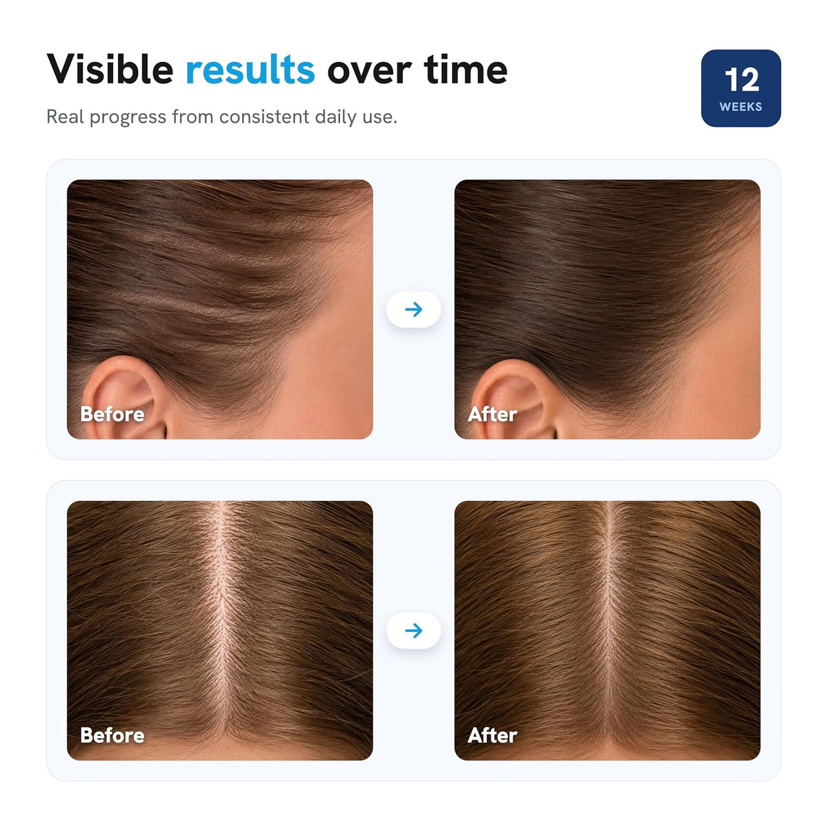 Hair Density Roll-On Serum - Advanced Scalp Actives For Fuller-Looking Hair
