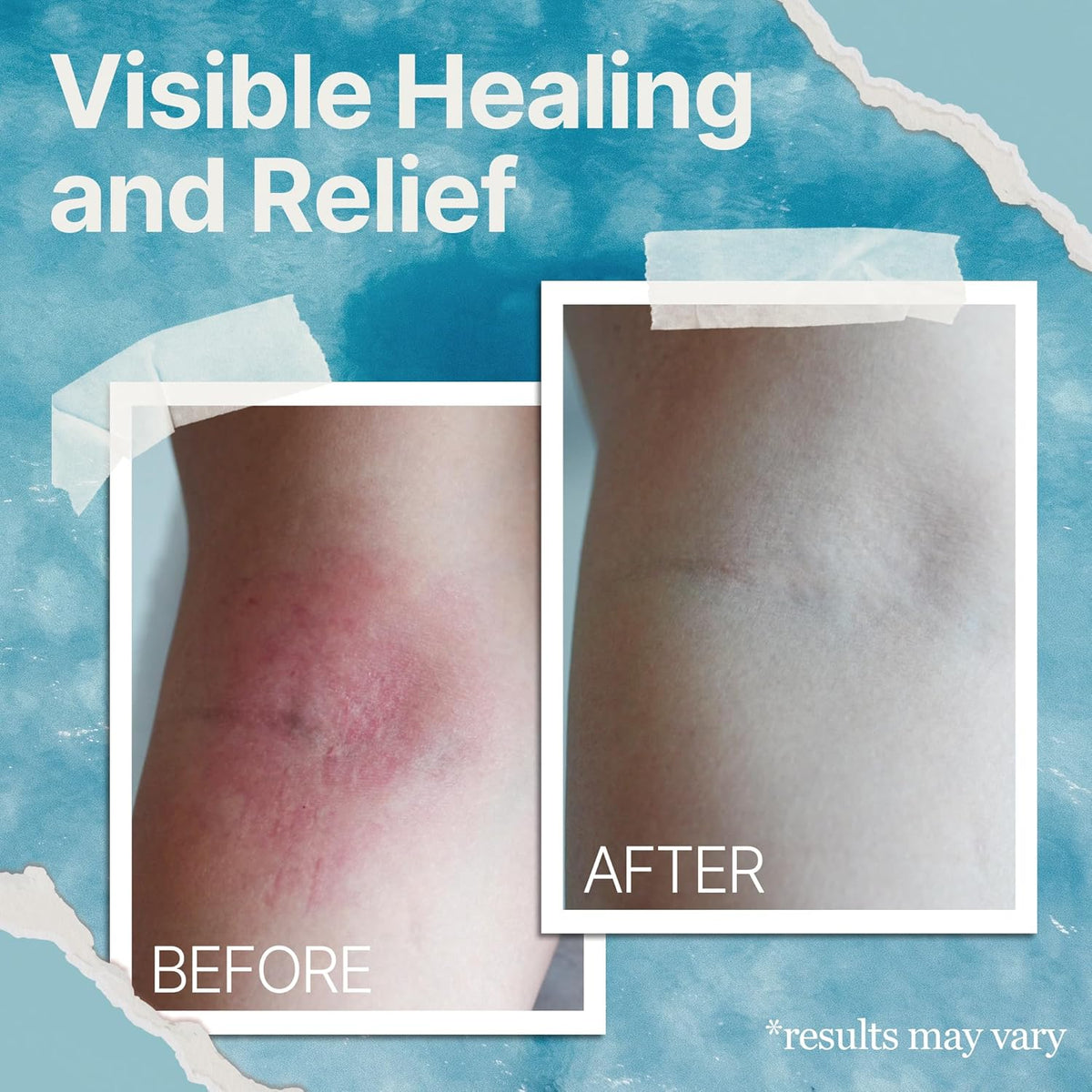 Soothing Skin Cream - Sea Moss & Oats For Dry, Sensitive Skin