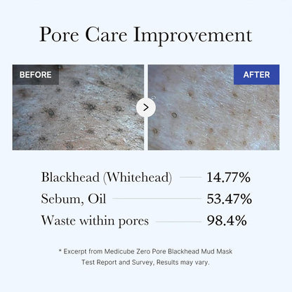 3-Minute Blackhead Mud Mask-Deep Pore Cleansing For Smoother-Looking Skin