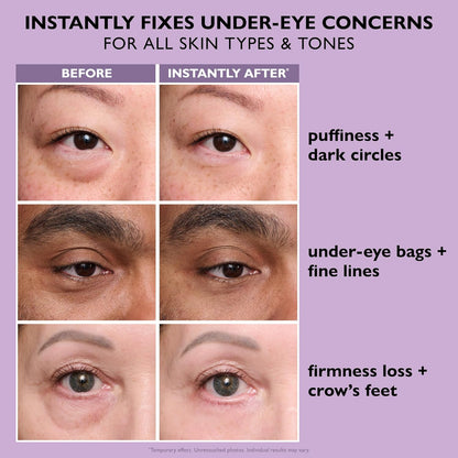 Eye Tightening Gel - Instant Temporary Smoothing Effect For Under-Eye Bags & Wrinklesa