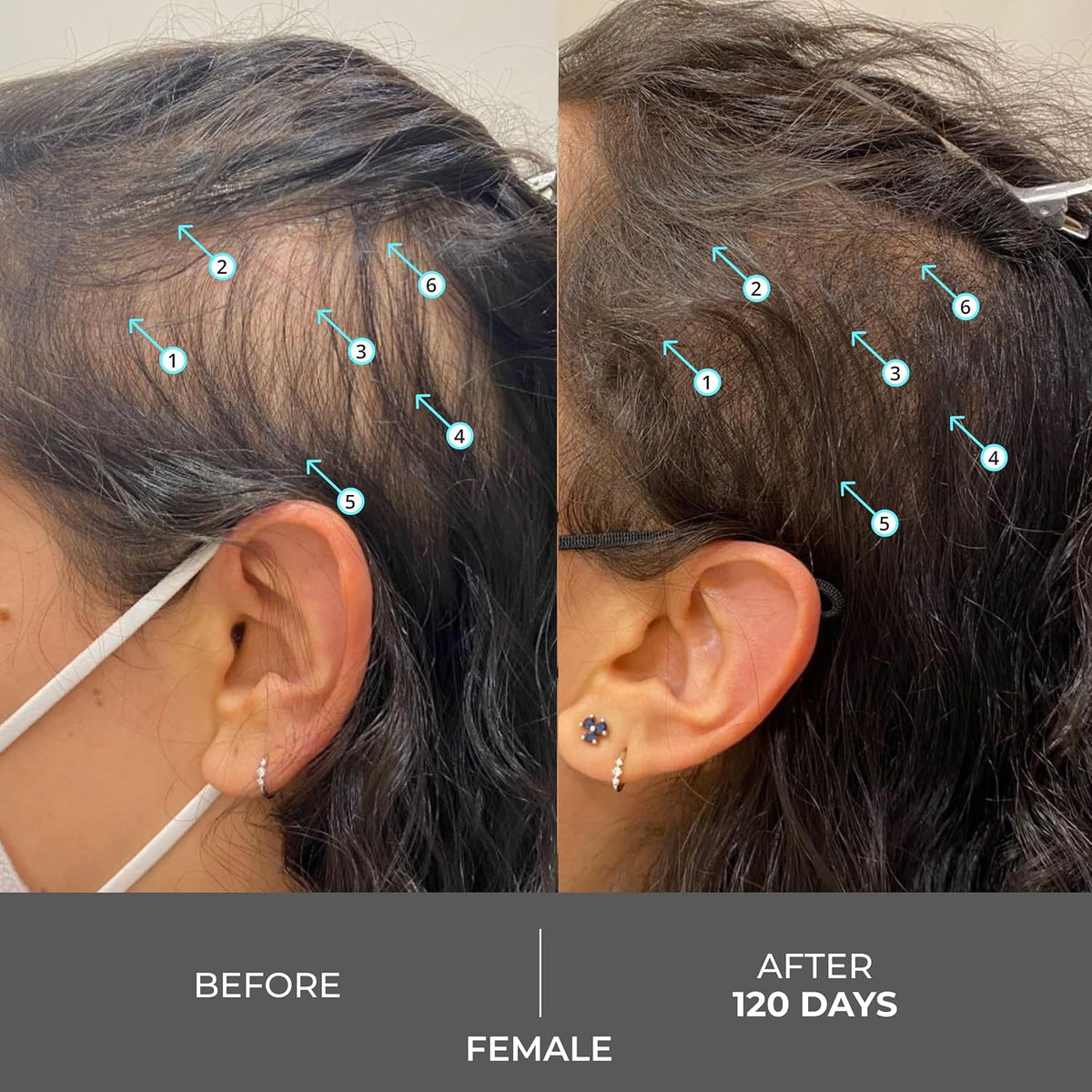 Hair Density Shampoo - Advanced Formula For Fuller, Thicker-Looking Hair