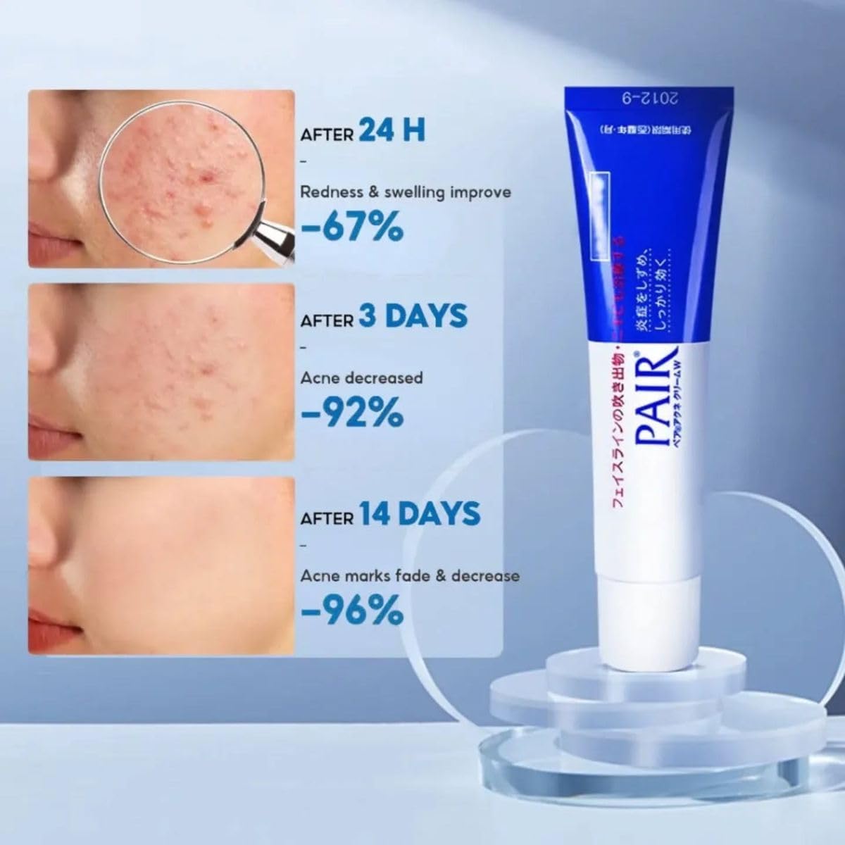 A lightweight Japanese spot-care cream that blends easily into your everyday skincare routine