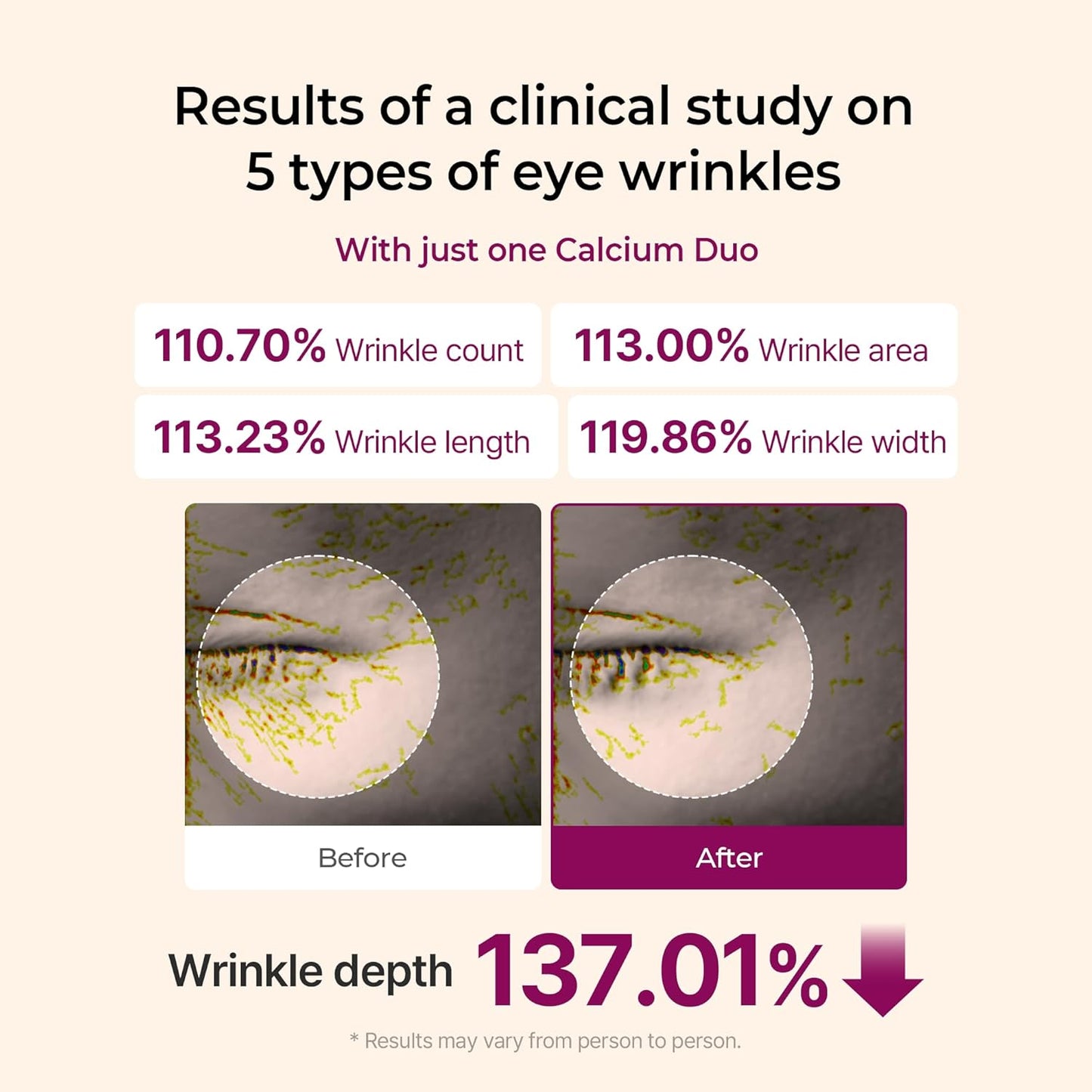 Rebuild Skin Elasticity Layer by Layer With Targeted Multi-Collagen
