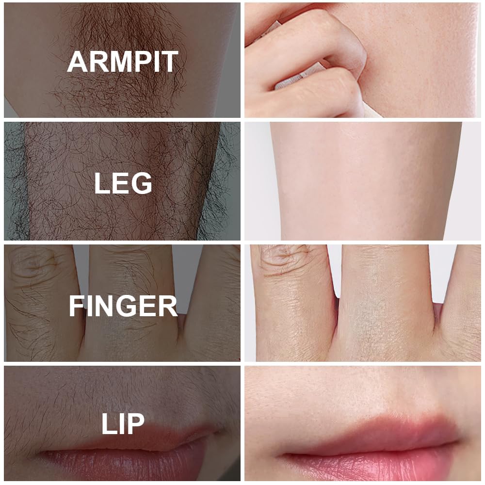 Hair Removal Spray - Gentle Spray-On Formula For Smooth Skin