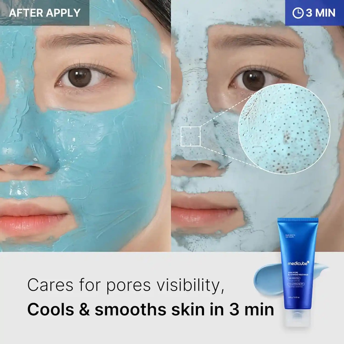 Pore Clay Mask – 3-Min Mud Absorption For Rapid Blackhead Dissolving