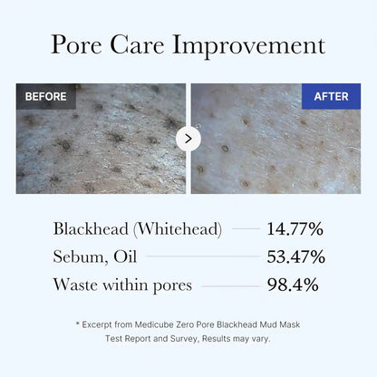 Pore Clay Mask – 3-Min Mud Absorption For Rapid Blackhead Dissolving
