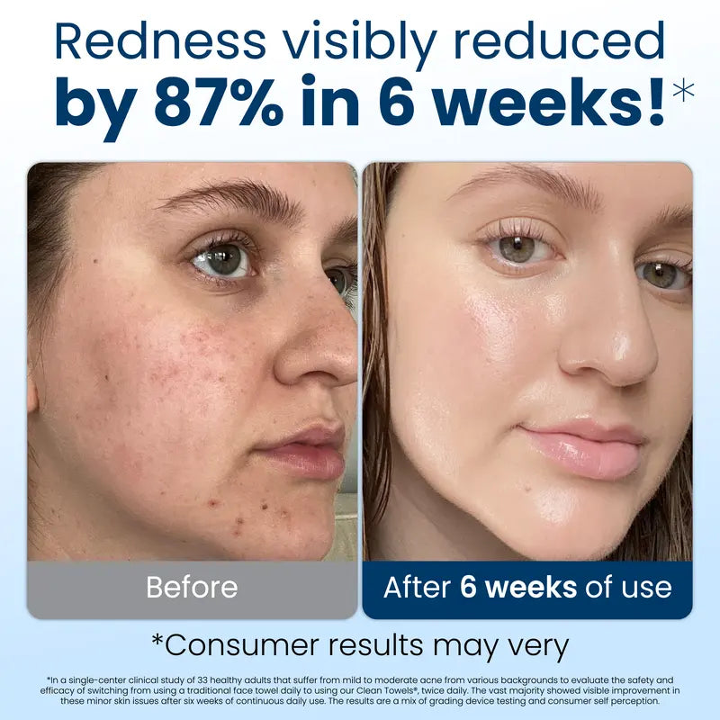 Bio-Based Face Towels – Micro-Weave Dry Wipes For Clean, Glowing Skin