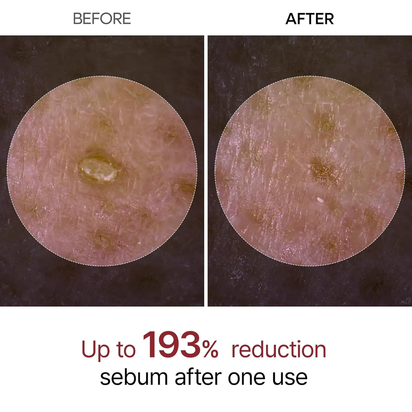 Glow Rice Ampoule – Gentle Micro-Peeling Technology For Flawless Glass Skin