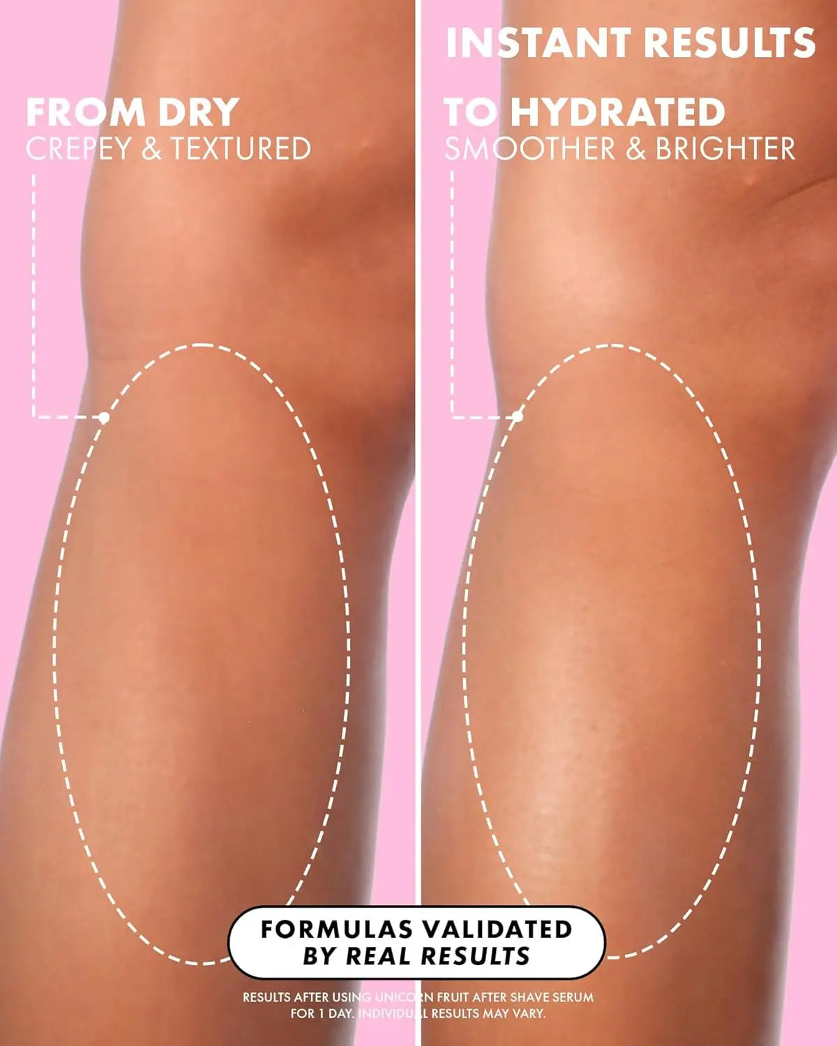 Post-Shave Body Serum – Stop Razor Bumps & Smooth Skin Fast